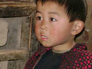 失神性癫痫能治好吗