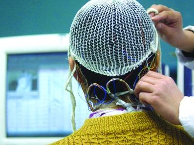 哪些原因造成脑电图异常